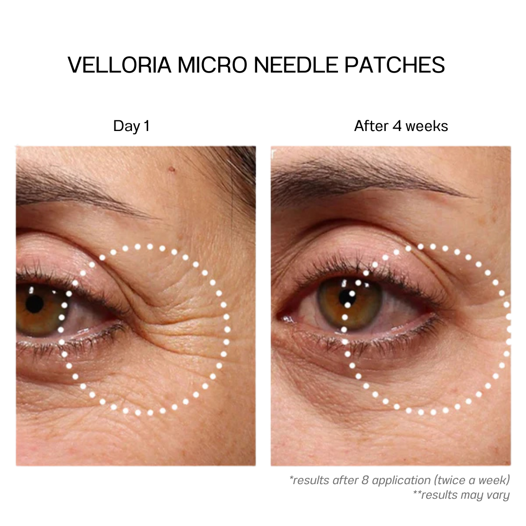 MICRONEEDLE EYE PATCHES - essential starter kit